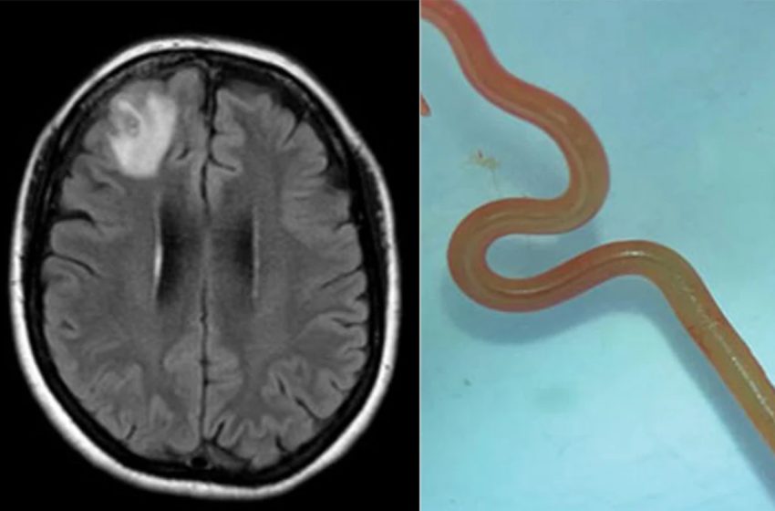Découverte d’un ver qui parasite les serpents dans le cerveau
