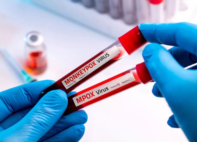 Virus Mpox : Le Royaume-Uni renforce sa défense