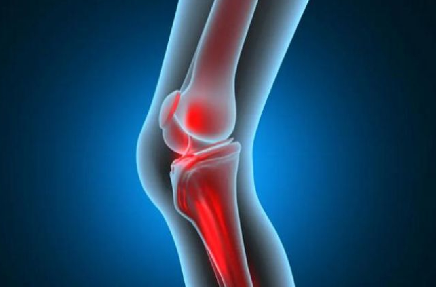  علماء يبتكرون مادة مسامية لتسريع شفاء العظام